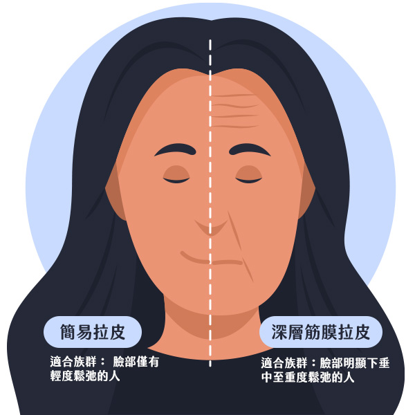 中下臉拉皮手術的種類