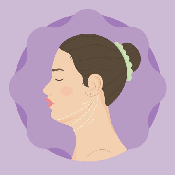 移除淺層與深層脂肪