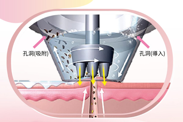 專利親膚水螺旋技術