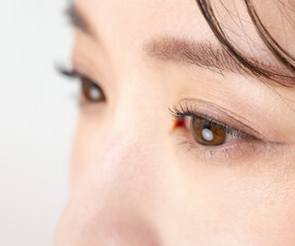 眉切手術/內視鏡隱痕提眉手術