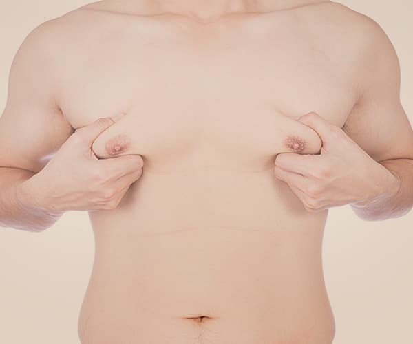 男性女乳症手術