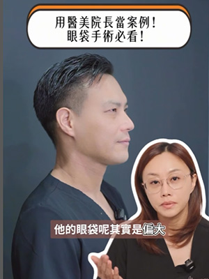 用醫美院長當案例!眼袋手術必看!