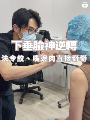 下垂臉神逆轉，法令紋嘴邊肉直接掰掰