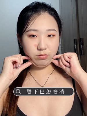 雙下巴到底要怎麼處理